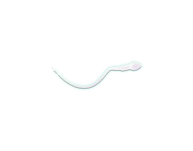 gif of a moving sperm